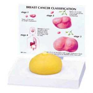 Anatomical Breast Cancer Model Health Products