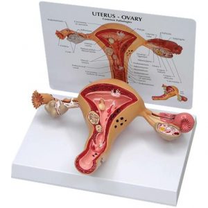 Anatomical Uterus and Ovary Model with Pathologies Health Products